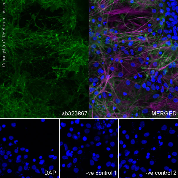Immunocytochemistry/ Immunofluorescence - Anti-EAAT2 antibody [EPR29552-528] - BSA and Azide free (AB324021)