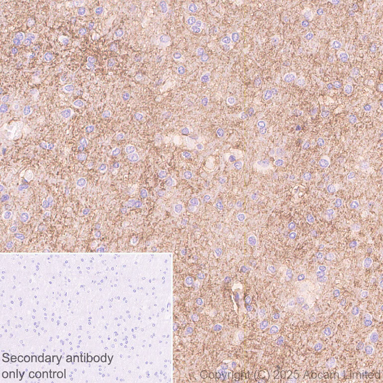 Immunohistochemistry (Formalin/PFA-fixed paraffin-embedded sections) - Anti-EAAT2 antibody [EPR29552-528] - BSA and Azide free (AB324021)