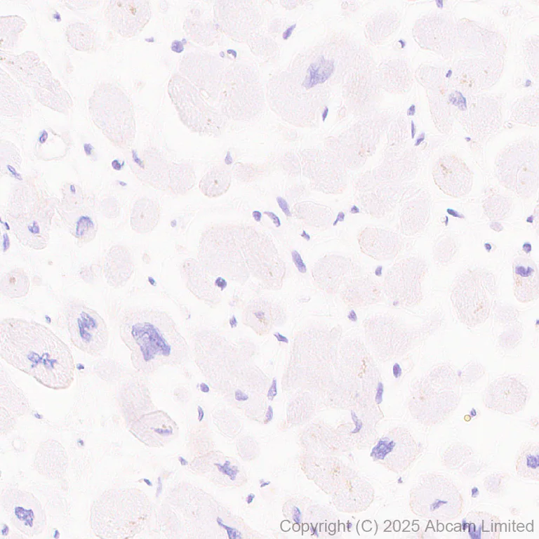 Immunohistochemistry (Formalin/PFA-fixed paraffin-embedded sections) - Anti-EAAT2 antibody [EPR29552-528] - BSA and Azide free (AB324021)