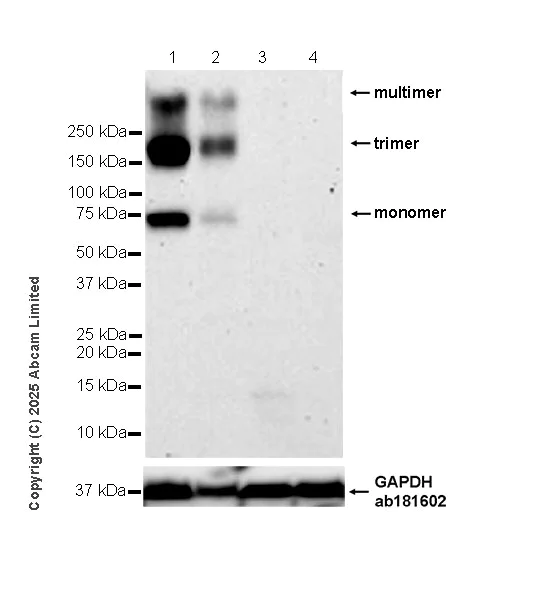 Western blot - Anti-EAAT2 antibody [EPR29552-528] - BSA and Azide free (AB324021)