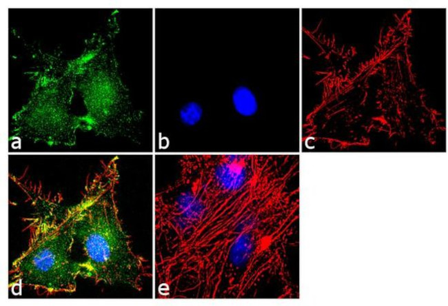 Immunocytochemistry/ Immunofluorescence - Anti-EAAT2 Antibody [RP23040136] (AB313454), expandable thumbnail