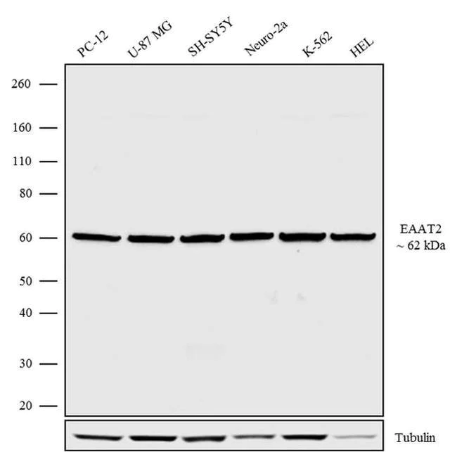 Western blot - Anti-EAAT2 Antibody [RP23040136] (AB313454)
