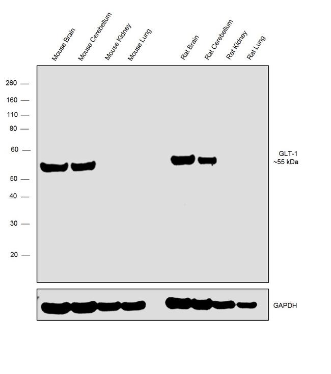 Western blot - Anti-EAAT2 Antibody [RP23040136] (AB313454), expandable thumbnail