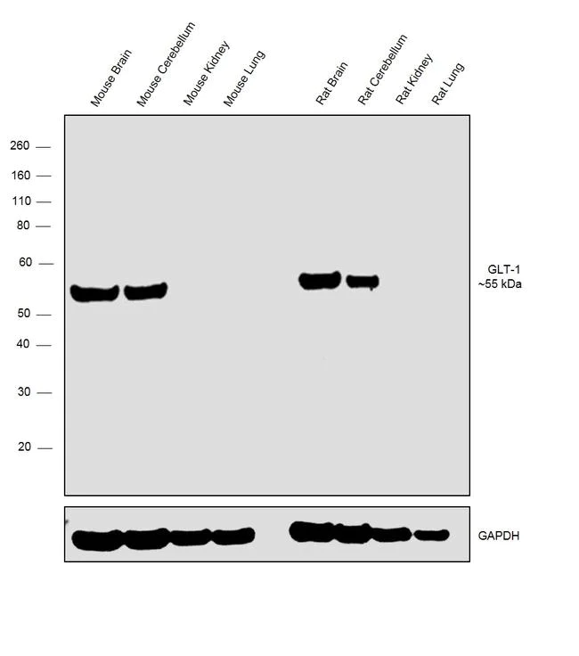 Western blot - Anti-EAAT2 Antibody [RP23040136] (AB313454)