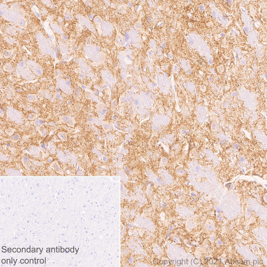 Immunohistochemistry (Formalin/PFA-fixed paraffin-embedded sections) - Anti-EAAT3 antibody [EPR25149-62] (ab288441), expandable thumbnail