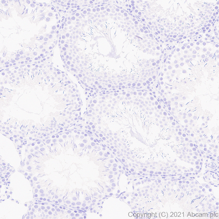 Immunohistochemistry (Formalin/PFA-fixed paraffin-embedded sections) - Anti-EAAT3 antibody [EPR25149-62] (ab288441), expandable thumbnail