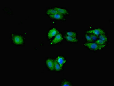 Immunocytochemistry/ Immunofluorescence - Anti-EAAT5 antibody (AB230217), expandable thumbnail