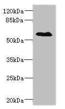 Western blot - Anti-EAAT5 antibody (AB230217), expandable thumbnail