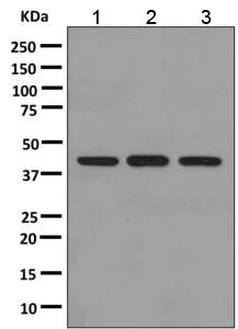 Western blot - Anti-EAF2 antibody [EPR7117(2)] (AB151692)