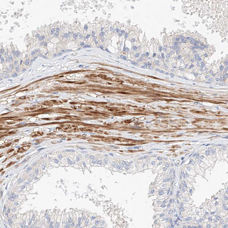 Immunohistochemistry (Formalin/PFA-fixed paraffin-embedded sections) - Anti-EAG2 antibody (AB224482), expandable thumbnail