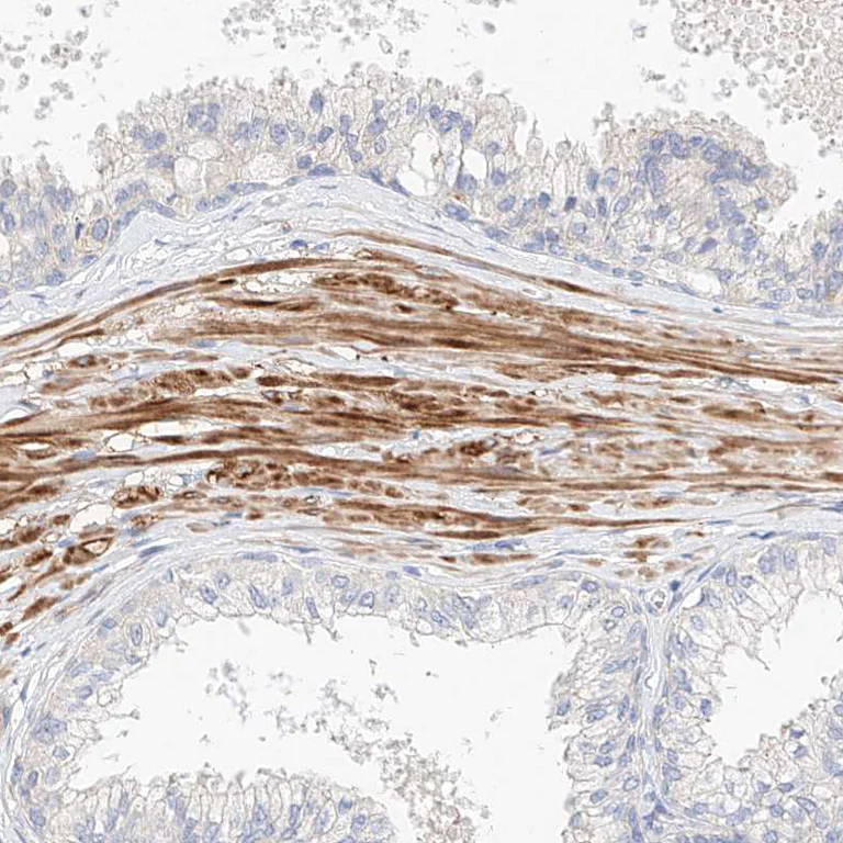 Immunohistochemistry (Formalin/PFA-fixed paraffin-embedded sections) - Anti-EAG2 antibody (AB224482)