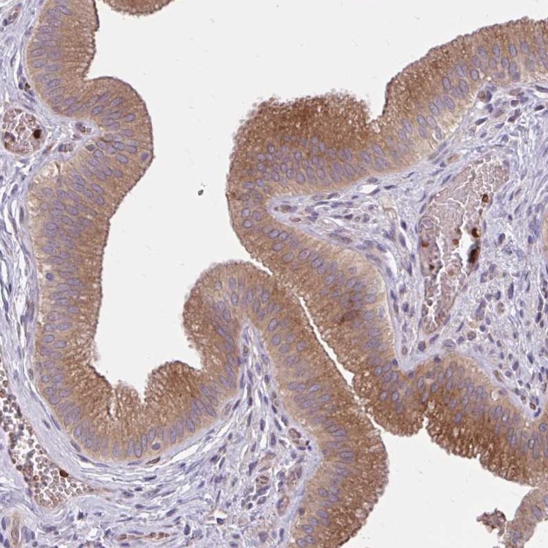Immunohistochemistry (Formalin/PFA-fixed paraffin-embedded sections) - Anti-EAP30 antibody (AB251956), expandable thumbnail