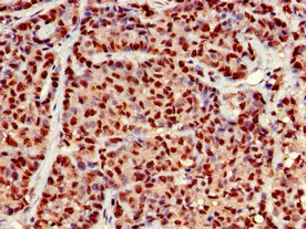 Immunohistochemistry (Formalin/PFA-fixed paraffin-embedded sections) - Anti-EARS2 antibody (AB225913)