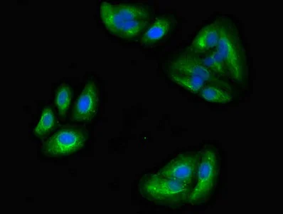 Immunocytochemistry/ Immunofluorescence - Anti-EB2 antibody (AB234843)