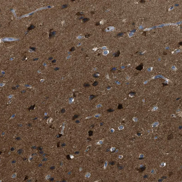 Immunohistochemistry (Formalin/PFA-fixed paraffin-embedded sections) - Anti-EB2 antibody (AB253008)