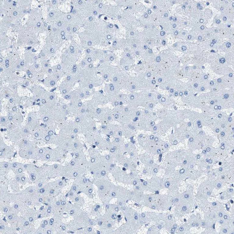 Immunohistochemistry (Formalin/PFA-fixed paraffin-embedded sections) - Anti-EB2 antibody (AB253008)