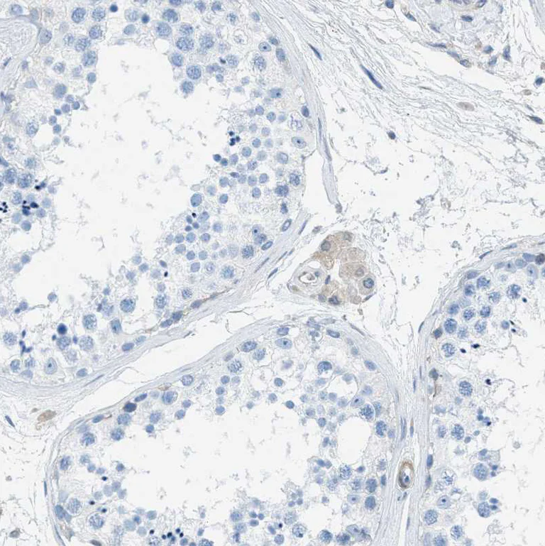 Immunohistochemistry (Formalin/PFA-fixed paraffin-embedded sections) - Anti-EB2 antibody (AB253008)