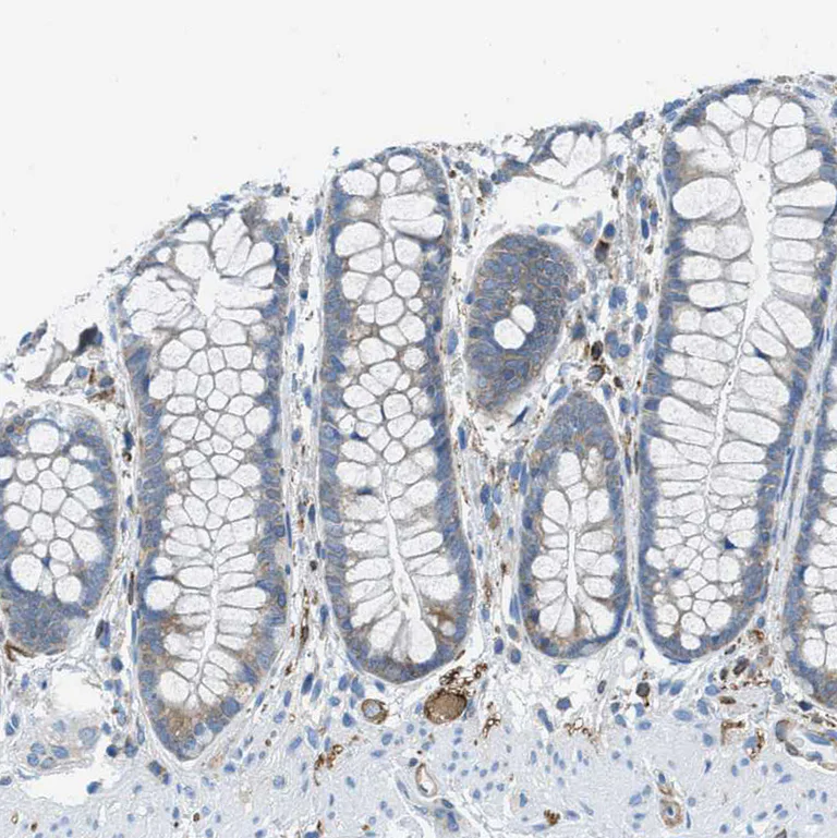 Immunohistochemistry (Formalin/PFA-fixed paraffin-embedded sections) - Anti-EB2 antibody (AB253008)