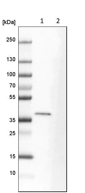 Western blot - Anti-EB2 antibody (AB253008)