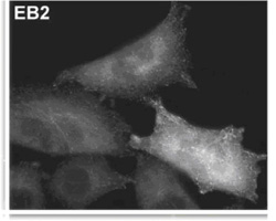 Immunocytochemistry/ Immunofluorescence - Anti-EB2 antibody [KT52] (AB45767)