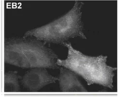 Immunocytochemistry/ Immunofluorescence - Anti-EB2 antibody [KT52] (AB45767)