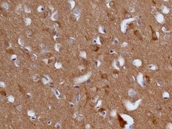 Immunohistochemistry (Formalin/PFA-fixed paraffin-embedded sections) - Anti-EB3 antibody [EPR11421(B)] (AB157217), expandable thumbnail