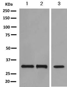 Western blot - Anti-EB3 antibody [EPR11421(B)] (AB157217)