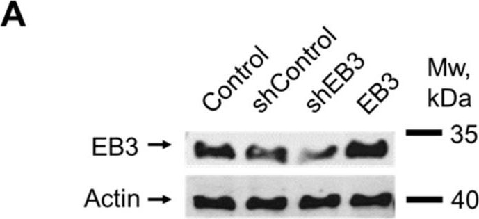 Western blot - Anti-EB3 antibody [EPR11421(B)] (ab157217), expandable thumbnail