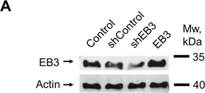 Western blot - Anti-EB3 antibody [EPR11421(B)] (AB157217)