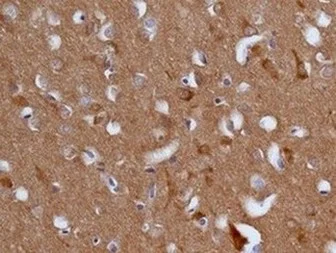 Immunohistochemistry (Formalin/PFA-fixed paraffin-embedded sections) - Anti-EB3 antibody [EPR11421(B)] - BSA and Azide free (AB246357)