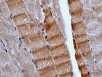 Immunohistochemistry (Formalin/PFA-fixed paraffin-embedded sections) - Anti-EB3 antibody [EPR11421(B)] - BSA and Azide free (AB246357)