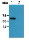 Western blot - Anti-EB3 (phospho S162) antibody [KT113] (AB179877)