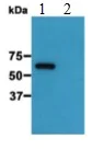 Western blot - Anti-EB3 (phospho S162) antibody [KT113] (AB179877)