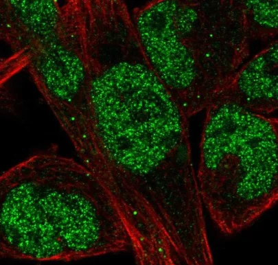 Immunocytochemistry/ Immunofluorescence - Anti-EBF1 antibody (AB221033)