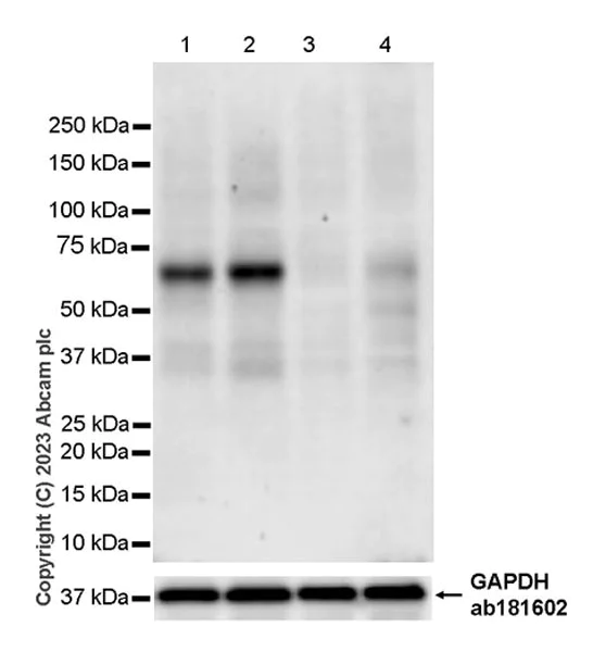 Western blot - Anti-EBF1 antibody [EPR27344-49] - BSA and Azide free (AB315451)