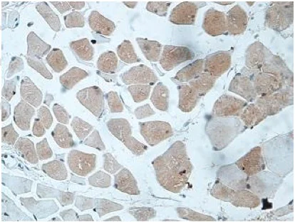 Immunohistochemistry (Formalin/PFA-fixed paraffin-embedded sections) - Anti-EBF3 antibody (AB207705)