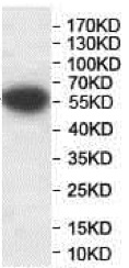 Western blot - Anti-EBF3 antibody (AB207705), expandable thumbnail