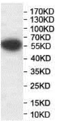 Western blot - Anti-EBF3 antibody (AB207705)