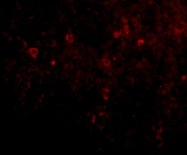 Immunocytochemistry/ Immunofluorescence - Anti-EBI3 antibody (AB83896)