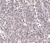 Immunohistochemistry (Formalin/PFA-fixed paraffin-embedded sections) - Anti-EBI3 antibody (AB83896)