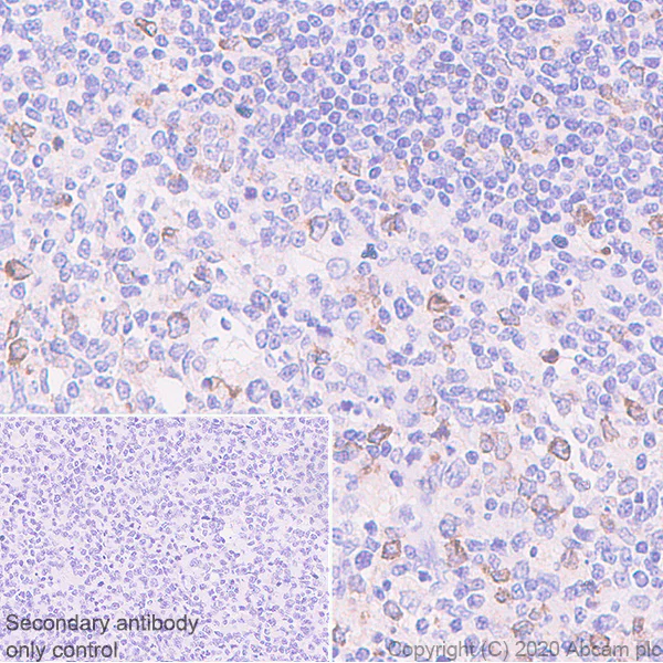 Immunohistochemistry (Formalin/PFA-fixed paraffin-embedded sections) - Anti-EBI3 antibody [EPR23372-282] (AB272709)