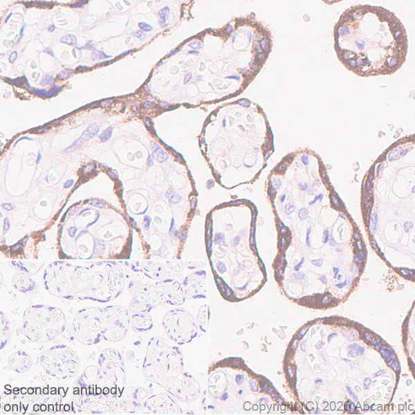 Immunohistochemistry (Formalin/PFA-fixed paraffin-embedded sections) - Anti-EBI3 antibody [EPR23372-282] (AB272709)