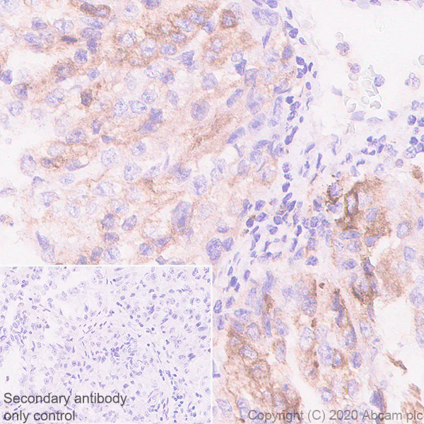 Immunohistochemistry (Formalin/PFA-fixed paraffin-embedded sections) - Anti-EBI3 antibody [EPR23372-282] (AB272709)