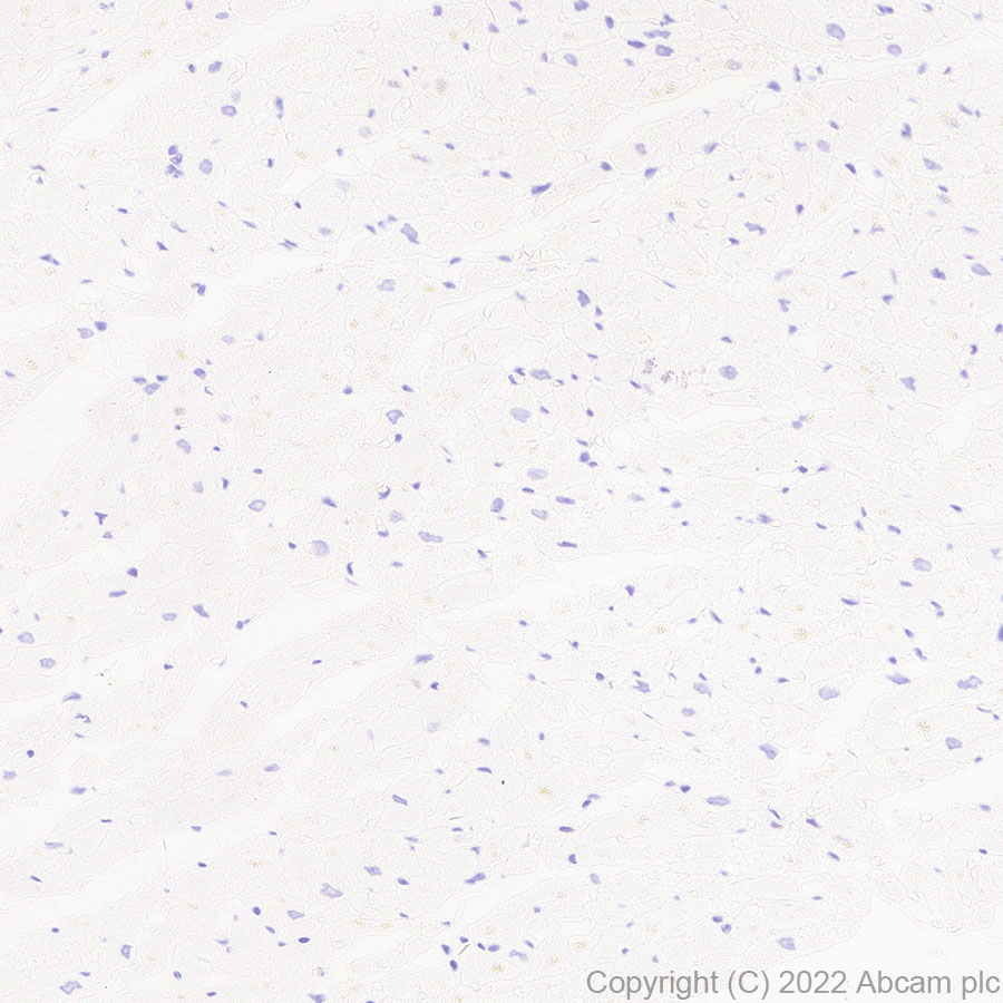 Immunohistochemistry (Formalin/PFA-fixed paraffin-embedded sections) - Anti-EBI3 antibody [EPR25341-155] (AB307195), expandable thumbnail