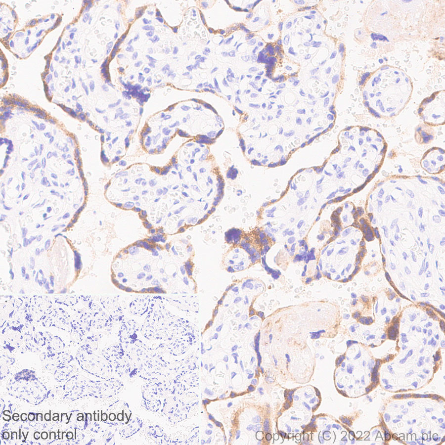 Immunohistochemistry (Formalin/PFA-fixed paraffin-embedded sections) - Anti-EBI3 antibody [EPR25341-155] (AB307195), expandable thumbnail