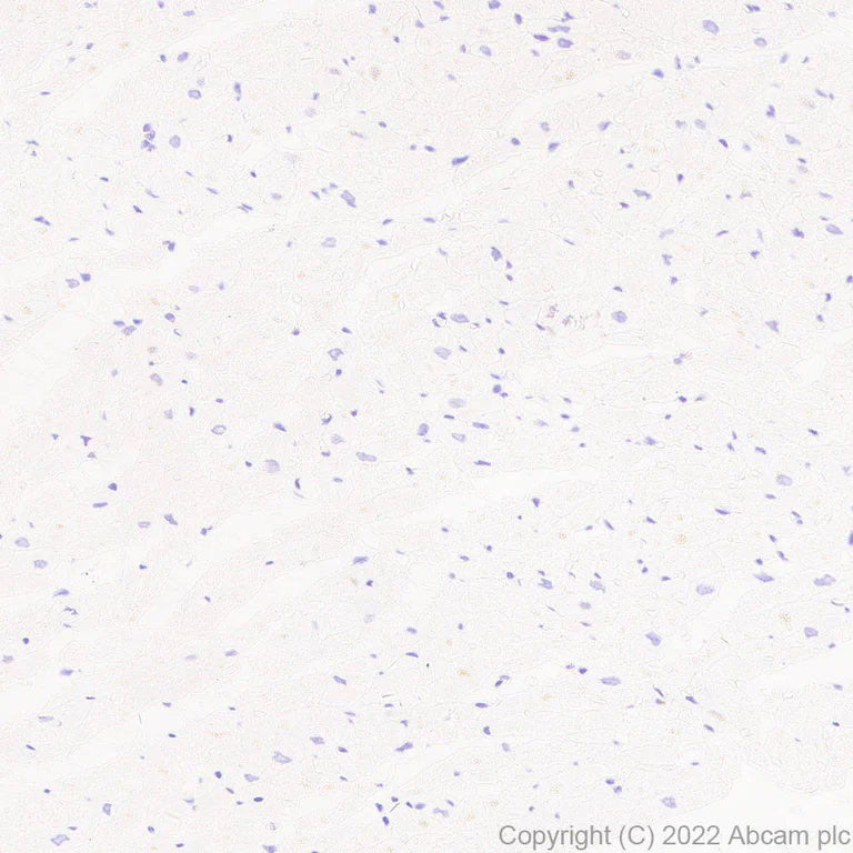 Immunohistochemistry (Formalin/PFA-fixed paraffin-embedded sections) - Anti-EBI3 antibody [EPR25341-155] - BSA and Azide free (AB307196)