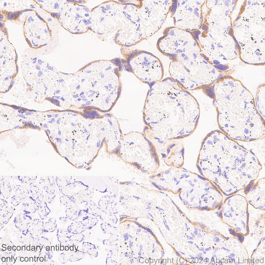 Immunohistochemistry (Formalin/PFA-fixed paraffin-embedded sections) - Anti-EBI3 antibody [RM2064] - BSA and Azide free (AB319169), expandable thumbnail