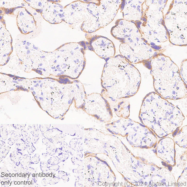Immunohistochemistry (Formalin/PFA-fixed paraffin-embedded sections) - Anti-EBI3 antibody [RM2064] - BSA and Azide free (AB319169)
