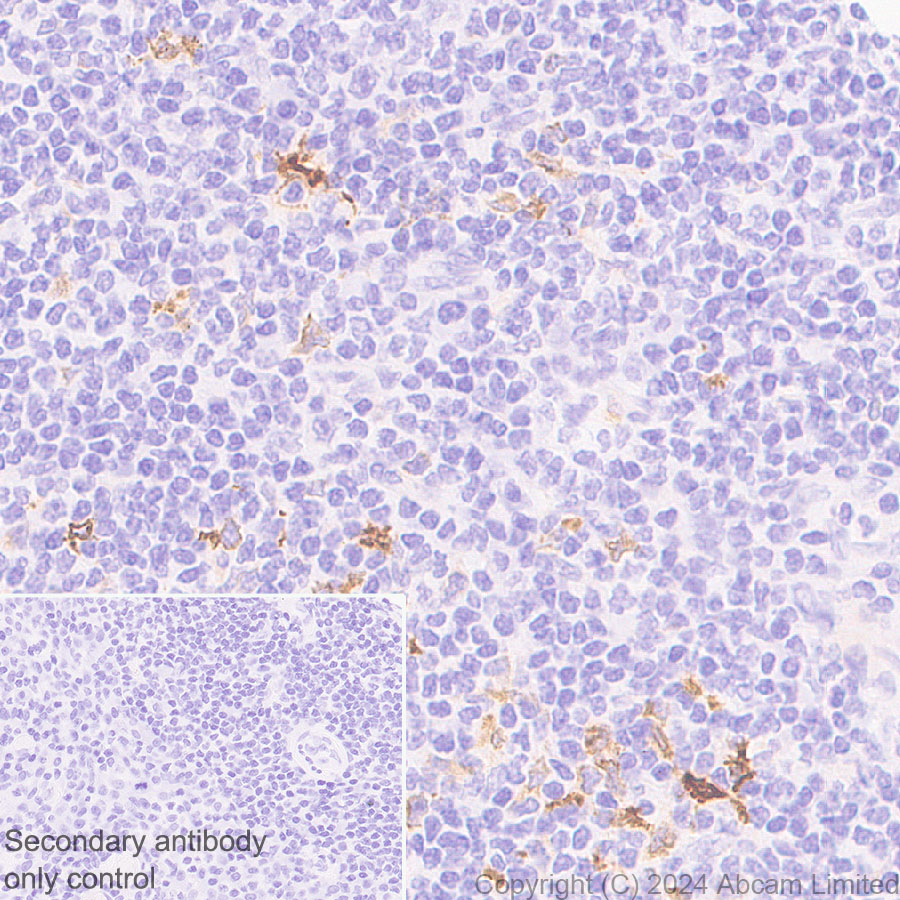 Immunohistochemistry (Formalin/PFA-fixed paraffin-embedded sections) - Anti-EBI3 antibody [RM2064] - BSA and Azide free (AB319169), expandable thumbnail