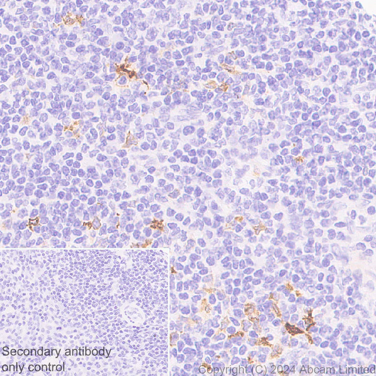 Immunohistochemistry (Formalin/PFA-fixed paraffin-embedded sections) - Anti-EBI3 antibody [RM2064] - BSA and Azide free (AB319169)